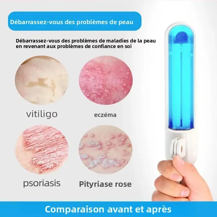 Lampe de thérapie UVB portative 311nm, efficace pour traiter le vitiligo, le psoriasis, l'eczéma, équipement de photothérapie UVB