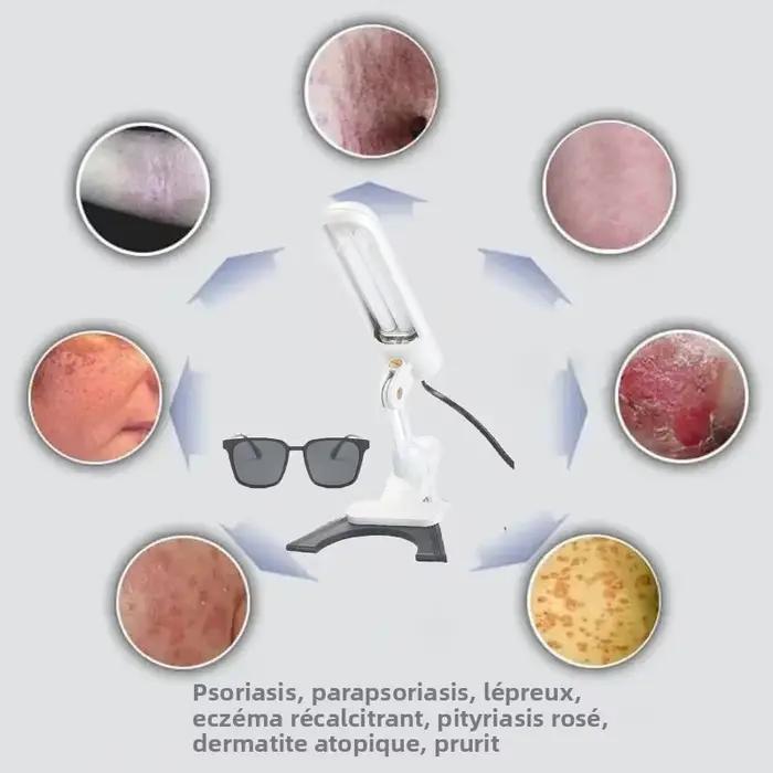 Lampe de thérapie UVB portative 311nm, efficace pour traiter le vitiligo, le psoriasis, l'eczéma, équipement de photothérapie UVB